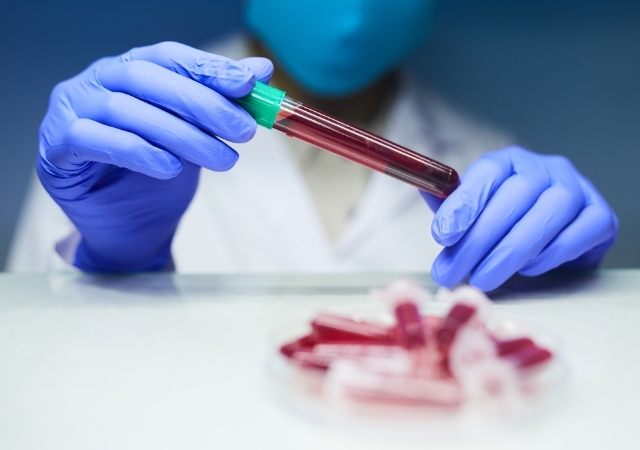 bahaya mikroplastik
